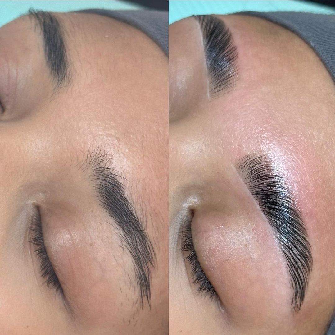 Before and after brow reshape